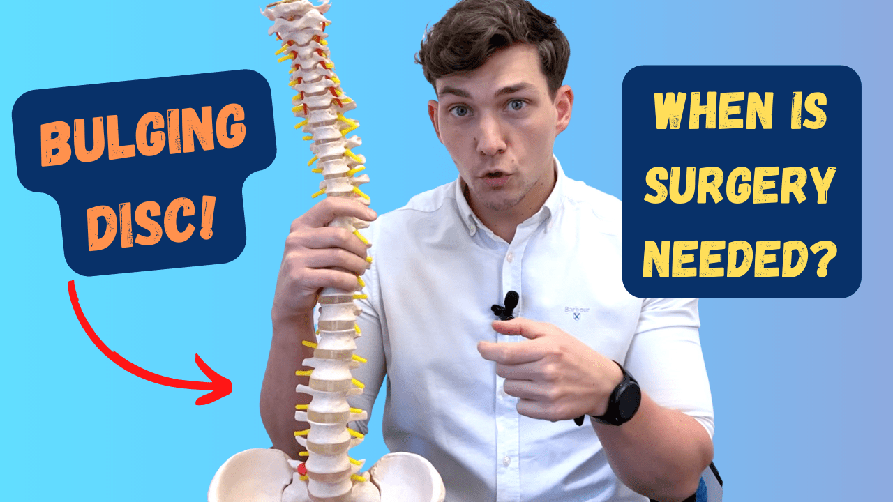 In this episode, Farnham's leading over-50's physiotherapist, Will Harlow, reveals the times when surgery might be a good idea for a bulging or herniated disc. Many people ask about surgery for bulging discs but, thankfully, it is rarely needed. However, there some instances when surgery is the right option. We reveal what these instances are today.