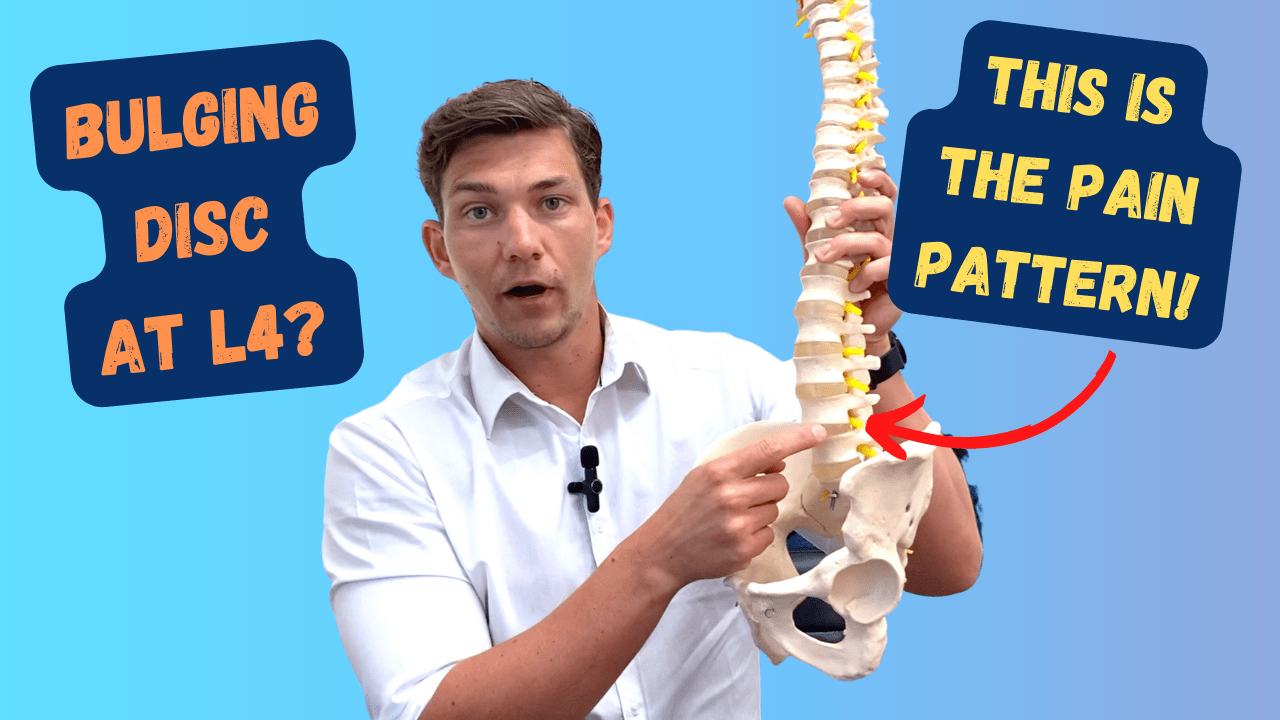 In this episode, Farnham's leading over-50's physiotherapist, Will Harlow, explains the pain pattern that occurs when the L4 nerve in the lower spine is pinched or irritated by a bulging or herniated disc. This video demonstrates the symptoms from this condition and shows the pain pattern in the legs that someone with this type of sciatica can expect.