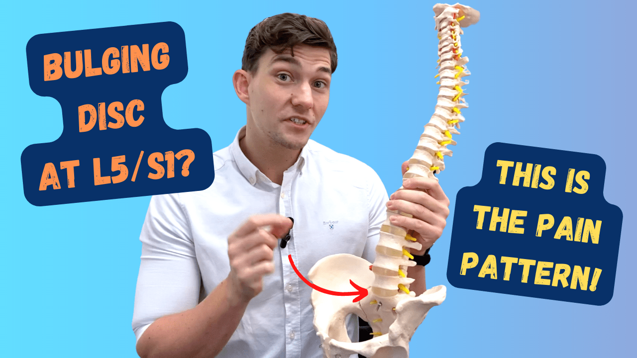 In this episode, Farnham's leading over-50's physiotherapist, Will Harlow, explains the pain pattern that occurs when the L5 or S1 nerves in the lower spine are pinched or irritated by a bulging or herniated disc.