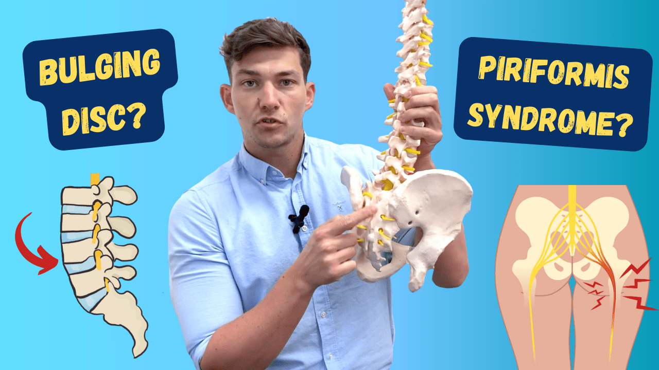 In this episode, Farnham's leading over-50's physiotherapist, Will Harlow, reveals how to tell whether a case of sciatica is caused by a bulging disc or piriformis syndrome. Both a bulging disc and piriformis syndrome can cause sciatica leg pain as well as numbness in the leg. For the average person, telling them apart can be difficult. However, there are some subtle signs that help to differentiate between these two conditions.